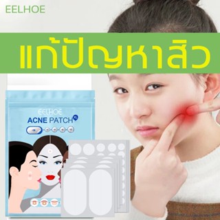 EELHOE แผ่นแปะสิว แผ่นแปะรักษาสิว รักษาสิว รักษาฝ้า จุดด่างดํา ซ่อมแซมผิว สติ๊กเกอร์แปะสิว เครื่องมือกำจัดสิว