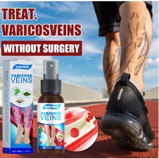 Varicose veins spray ทรีทเม้นท์นวดบรรเทาอาการเส้นเลือดขอด