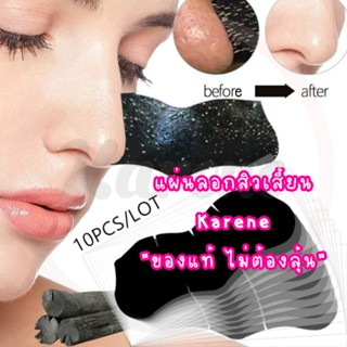 ดูวิธีใช้ก่อนนะคะ❗️แผ่นลอกสิวเสี้ยน10ชิ้น💥ฟรีซองซิปเก็บง่าย💥…