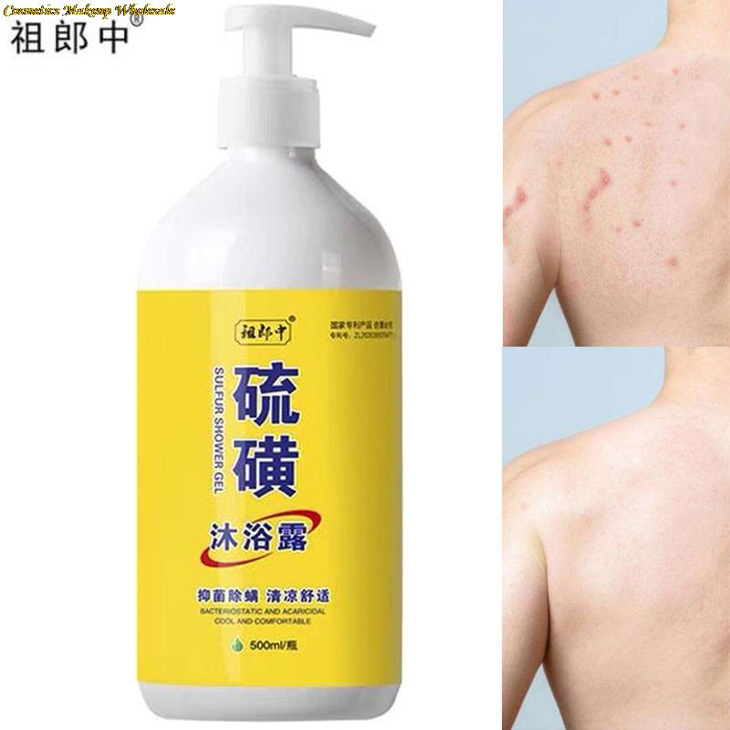 500ml Sulfur Ointment Scabies Mites Fat Body Wash Lotion Bath Skin Care