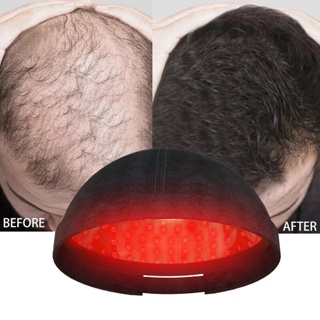 KTS Electric Laser Hair Generator Helmet Head Massager 118 Dense Lamp 10mW Hair Healthy Growth Cap