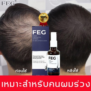 FEG สเปรย์ปลูกผม กระตุ้นรูขุมขนอย่างมีประสิทธิภาพ ช่วยให้ผมงอกใหม่เร็ว น้ำยาปลูกผม สเปรย์ปปลูกผม น้ำมันปลูกผม เซรั่มบำรุ