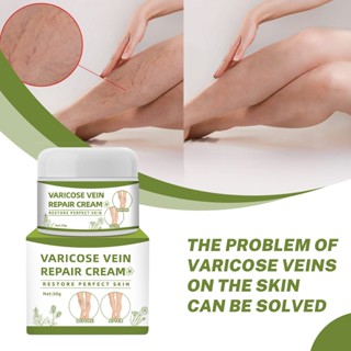 Vein On Legs ครีมนวดขา เส้นเลือดขอด ครีมทาเส้นเลือดขอด 50g ส่งเสริมการไหลเวียนโลหิต บรรเทาและกำจัดเส้นเลือดขอดและหลอดเลือดดำแมงมุม