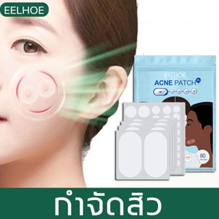 EELHOE แผ่นแปะรักษาสิว แผ่นแปะสิว รักษาสิว สติ๊กเกอร์ รักษาฝ้า จุดด่างดํา ซ่อมแซมผิว เครื่องมือกำจัดสิว มาส์กหน้า ซ่อมแซ