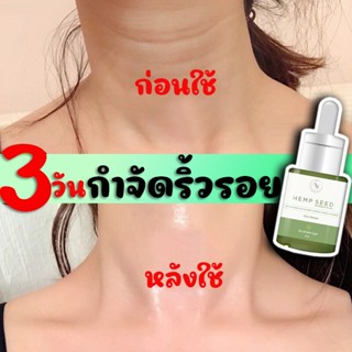 ✅ส่งฟรี✅ Siis Serum HEMP Seed เซรั่มผิวขาว เซรั่มลดสิว ลดรอยลดจุดด่างดำ บำรุงฟื้นฟูผิวหน้า ทาคอ  ทาได้ทั้งตัว พร้อมส่ง