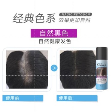 *พร้อมส่ง*Kingyes สเปร์ยไฟเบอร์ปิดผมขาว สเปรย์ฉีดผมไฟเบอร์เพิ่มวอลุ่มของผม  แก้ปัญหาหัวล้าน - รูปที่ 3