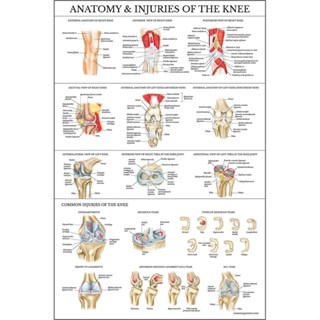 โปสเตอร์ผ้าใบ ไร้กรอบ รูปกายวิภาคศาสตร์ และบาดเจ็บที่เข่า