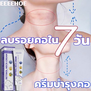 [รับประกัน 5 ปี] ครีมบำรุงลำคอ ครีมทาคอ ครีมทาคอเหี่ยว ไวท์เทนนิ่งและกระชับ ผิวคอเต่งตึง ริ้วรอยลำคอหายไปอย่างรวดเร ครีม