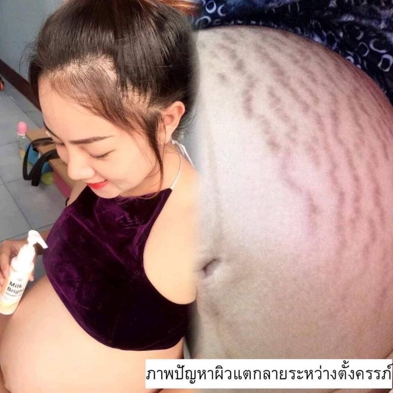 (ส่งด่วน)คู่จิ้น Duo เซ็ตจัดการแตกลาย ขนคุด รอยดำ รอยแผลเป็น น้ำเหลืองไม่ดี