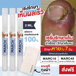 *สินค้าขายดี* MARCH NAIL AND CUTICLE มาร์ช ออยล์บำรุงเล็บ เซรั่มรักษาเล็บ เล็บบางจากการทำเล็บ ทาเล็บ เล็บขบ เชื้อราเล็บ