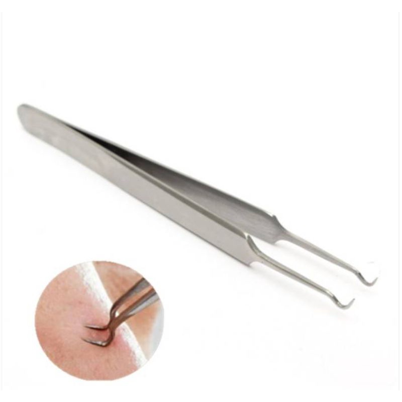 ที่กดสิว อุปกรณ์กำจัดสิวเสี้ยน