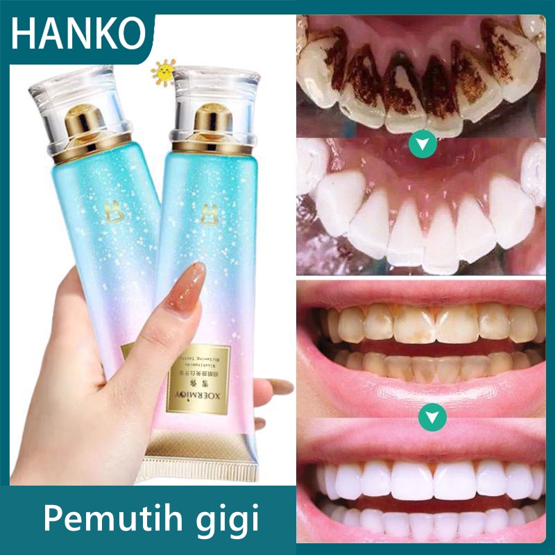 HAKO ยาสีฟันไวท์เทนนิ่ง Niacinamide Remover Pantas Berkesan Viral TikTok Ubat gigi Xoermioy