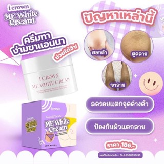 ครีมแอนนา Me White Cream ครีมทาง่ามขาแอนนา ทาคอดำ ขาหนีบ รักแร้ ข้อศอก ตาตุ่ม (30กรัม)