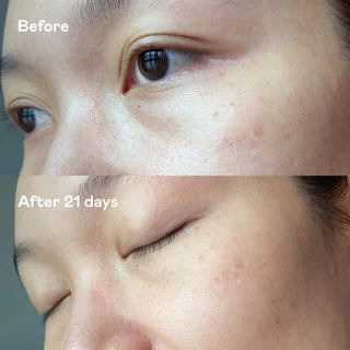 DIVYNE Revitalising Eye Rescue Cream 20g อายครีม ลดริ้วรอย รอยหมองคล้ำใต้ตา