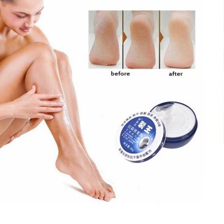 มือเท้าแตกครีมส้นเท้าแตกลอกต่อต้านแห้งซ่อมแซมชุ่มชื้น88ก