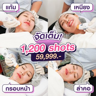 [E-voucher] THERMAGE ยกกระชับระดับพรีเมียม ทั่วหน้า 1,200 Shots MEGA CLINIC เมกะคลินิก