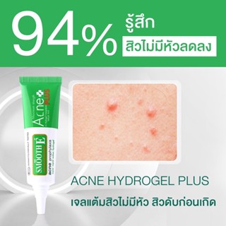 Smooth E Acne Plus สมูท อี แอคเน่ พลัส ปริมาณสุทธิ 10 g. ดูแลสิวอักเสบให้ยุบตัวอย่างรวดเร็ว