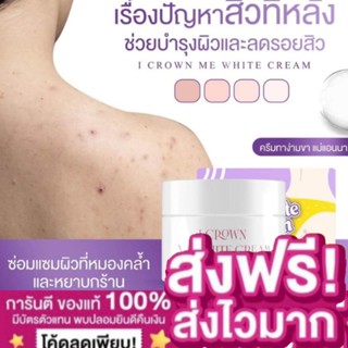 ❗พร้อมส่ง❗มีของแถม❗ครีมแก้ง่ามดำ ก้น ดำ แม่แอนนา