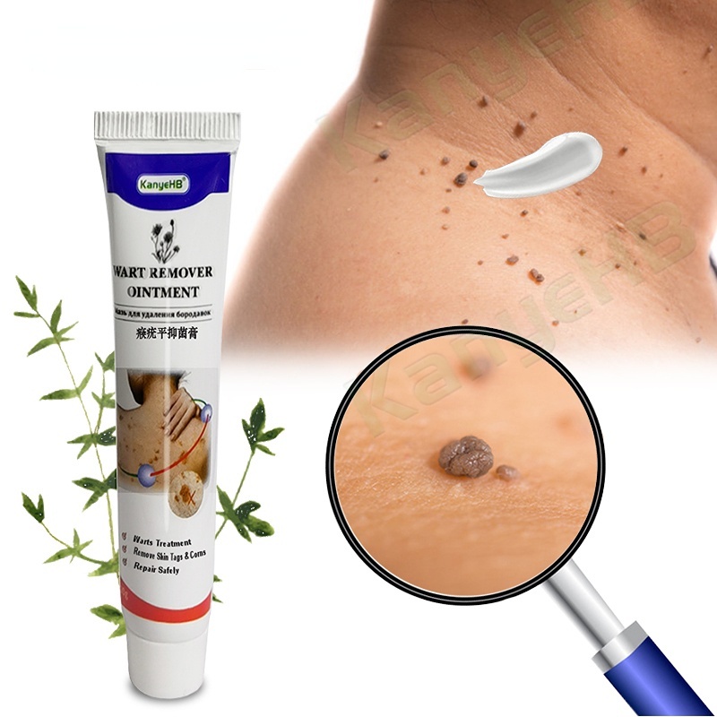 Warts Remover Ointment Wart Treatment ครีม Skin Tag Remover สมุนไพรสารสกัดจากข้าวโพด Calluses พลาสเตอร์ Wart Ointment Body Care 1 ชิ้น