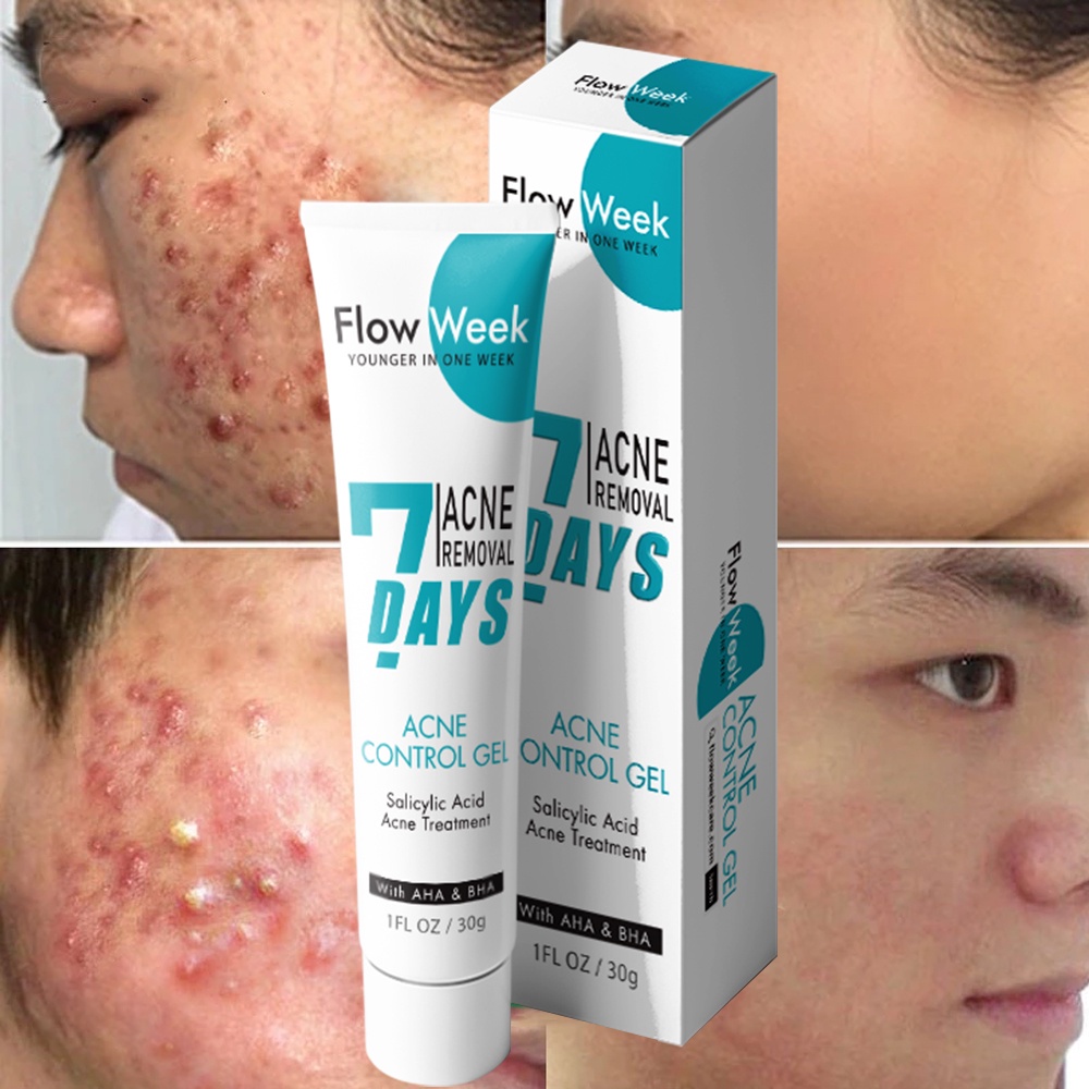 Flowweek Acne Remover SCAR Salicylic Acid scars removal for Face Cream