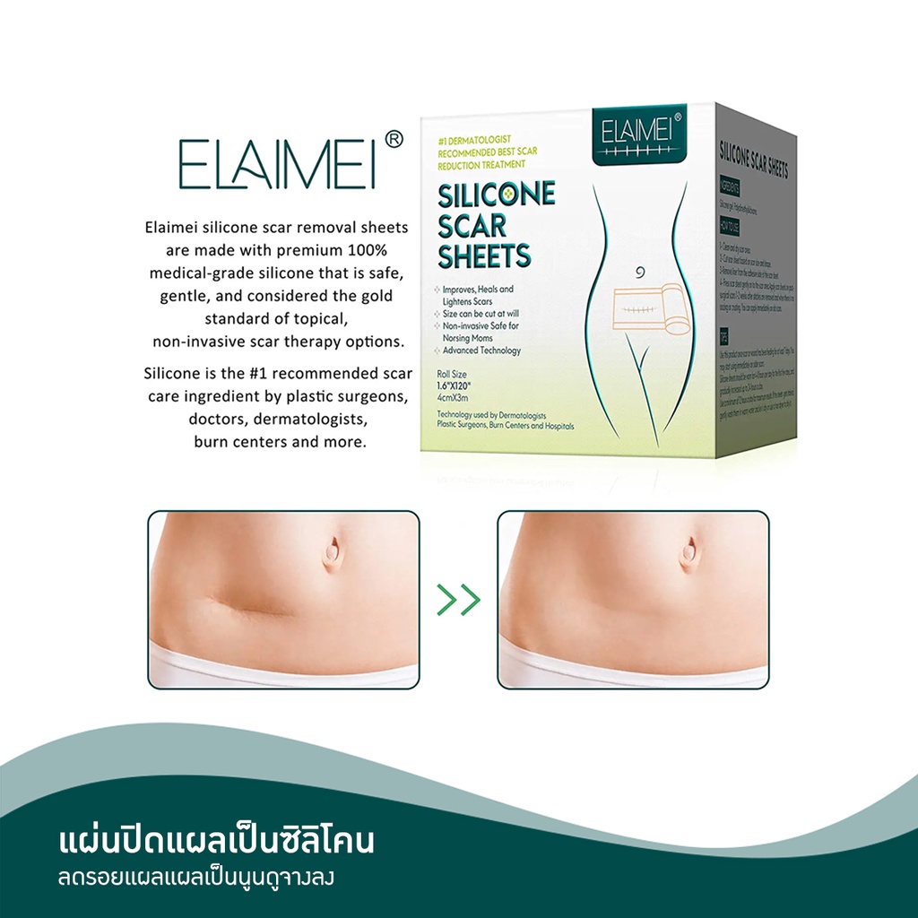 รูปภาพ 2