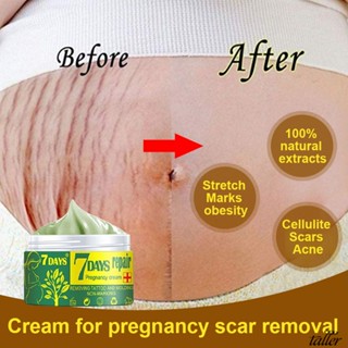 ✧ Ready Stcok Eelhoe 7วัน Pregnancy Repair Cream Body Stretch Marks Remove Acne Scar Removal หลังคลอด Repairing Moisturizing Skin Care Cream สูงกว่า