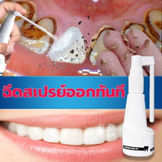 น้ำยากำจัดหินปูน   กำจัดหินปูนฟัน 30ML ฟอกฟันขาว ฟันขาว ยาสีฟันฟอกฟันขาว ลดคราบฟันเฟลือง หินปูน กลิ่นปาก เหงือกบวม แก้ฟันเหลือง