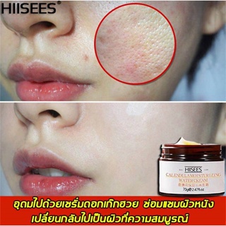 Hiisees ลดริ้วรอย ไวท์เทนนิ่ง เพิ่มความชุ่มชื้น ปรับปรุงผิวแพ้ง่าย และความไม่สมดุลผิวหน้า ครีมบำรุงหน้า ครีมทาหน้า