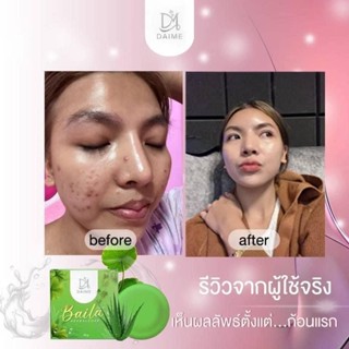 ของแท้พร้อมส่ง + มีบริการปลายทาง‼️🍀สบู่ใบล่าตัวเด็ดเรื่องสิว จุดด้างดำ