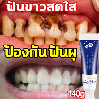 ยาสีฟันเบกกิ้งโซดา 140g ฟอกฟันขาว แก้ฟันเหลือง ​ยาสีฟันฟอกฟันขาว ยาสีฟันดีเด้นท์ ขจัดคราบเหลือง ลดเหงือกอักเสบลดกลิ่นปาก