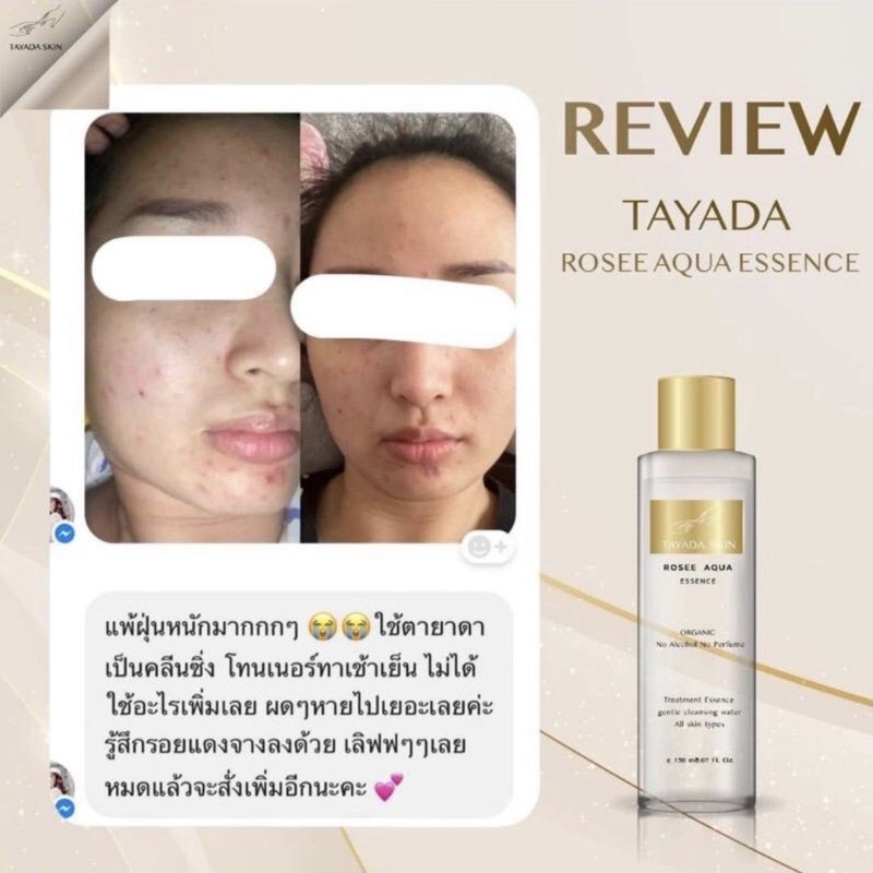 ┃พร้อมส่ง+ส่งฟรี┃💁‍♀️🌕 น้ำตบ คลีนซิง Tayada Skin rosee aqua essence 3 in 1 เป็นทั้งน้ำตบ คลิ่นซิ่ง มาส ผิวดี ชุ่มชื้น