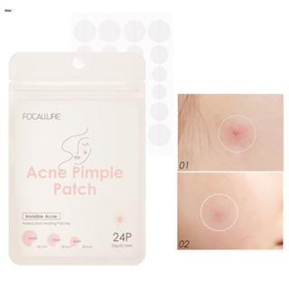 24Pcs Day And Night Tea Tree Extract Acne Removal Pimple Patch สติ๊กเกอร์ที่มองไม่เห็น Acne Pimple Removal Nuuo