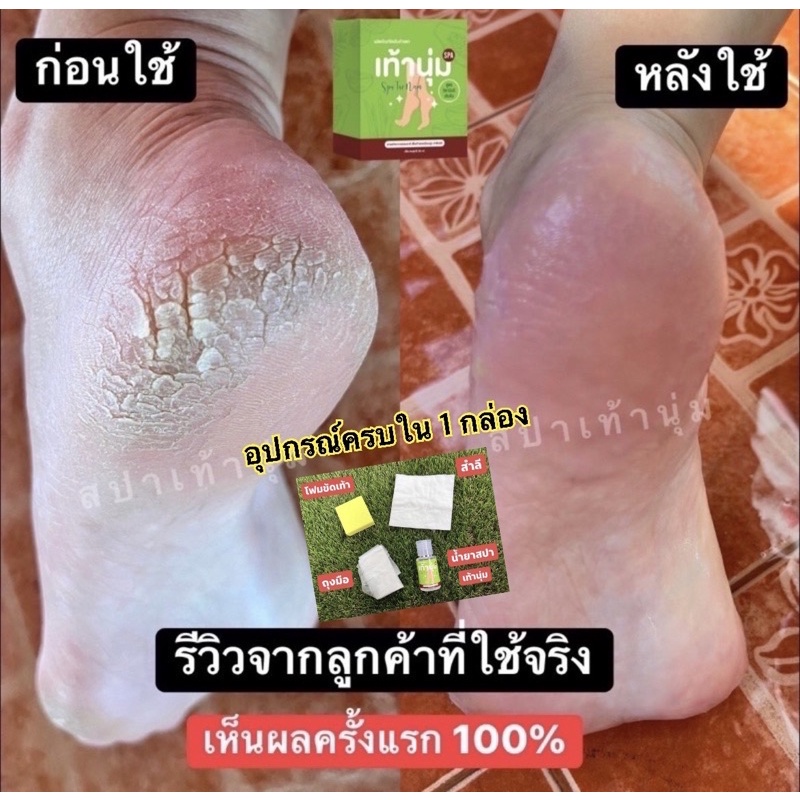 ขายดี🔥สปาขัดเท้าแตก แถมฟรีชุดขัด **ไม่มีกล่อง เห็นผลในครั้งแรก เท้าแตก เท้าด้าน ตาตุ่มด้าน