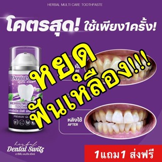 ส่งฟรี! 1แถม1 เจลฟอกฟันขาว เดนทัล สวิตซ์(Dental Switz) ช่วยให้ฟันขาว ขจัดคราบชา กาแฟ คราบหินปูน ฟันเหลือง ลดกลิ่นปาก