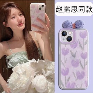 เปิด Pre Order Case Iphone ลายดอกไม้สีม่วงน่ารักๆแบบเจ้จ้าว