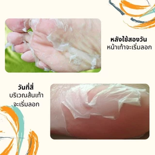 ถุงมาร์คเท้า มาร์คเท้า มาร์คเท้าเนียน แก้เท้าแตก เท้าด้าน ลอกได้ใน1-3 วัน ไม่เจ็บ