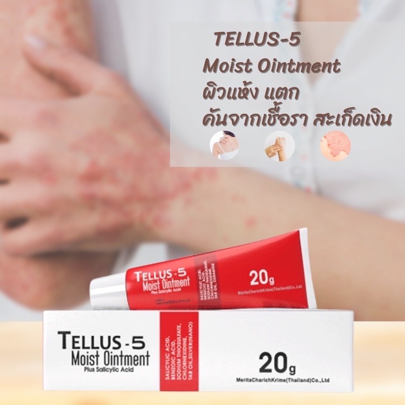 Tellus-5 Moist Ointment 20 g. เทลลัส-5 แบบทา เชื้อรา และอาการ คัน จากเชื้อรา รวมถึง สะเก็ดเงิน จำนวน 1 หลอด