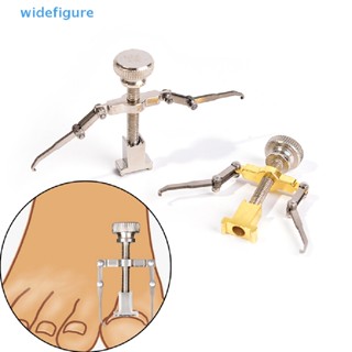 Widefigure เครื่องมือดูแลเล็บเท้า เล็บขบ แก้ไขเล็บขบ มืออาชีพ