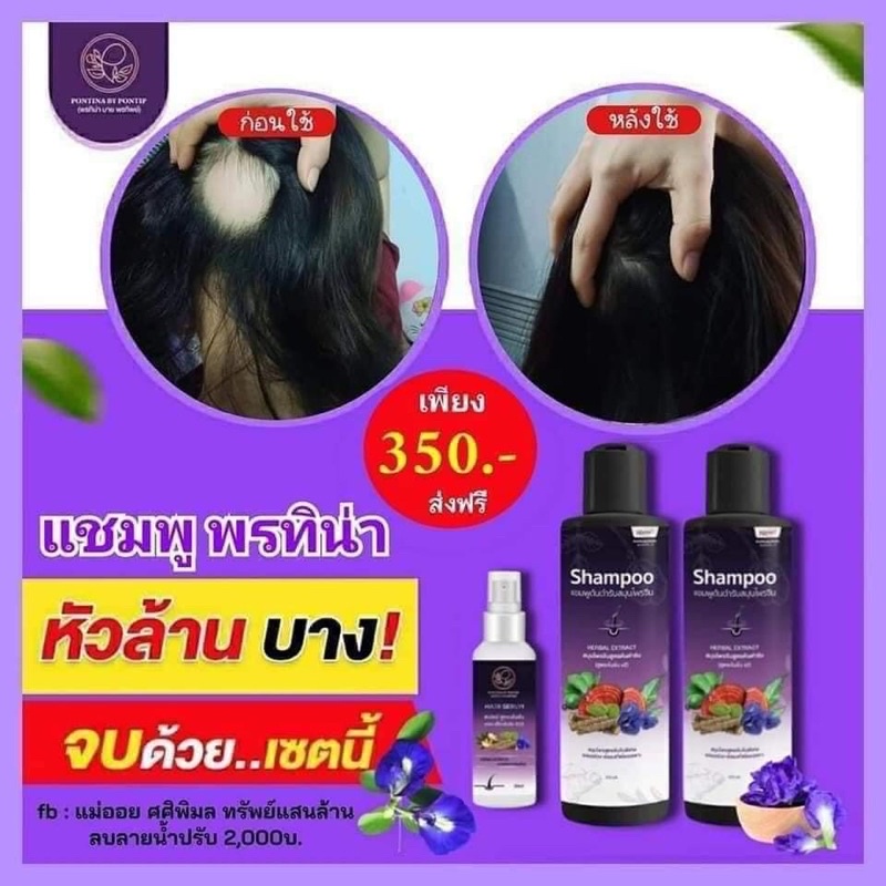 แชมพูพรทิน่าขวดใหญ่200ml(1ชุด3ชิ้น)แชมพู2ขวด+สเปรย์1ขวด