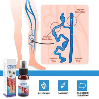 Varicose veins spray สเปรย์รักษาเส้นเลือดขอด