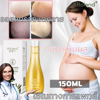 XRoland ครีมลดรอยแตก 150g ขาแตกลาย ลดรอยแตกลาย ครีมทาท้องลาย ครีมลดรอยแตกลาย แก้ท้องลาย กระชับผิวให้เรียบเนียน