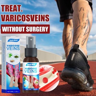 Varicose veins spray สเปรย์รักษาเส้นเลือดขอด