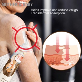 Mother &amp; Baby Vitiligo Cream สารสกัดสมุนไพรซ่อมแซมผิว Care for Skin Pigmentation 0.7oz
