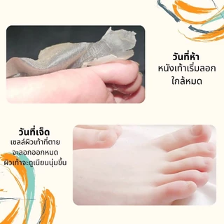 ถุงมาร์คเท้า มาร์คเท้า มาร์คเท้าเนียน แก้เท้าแตก เท้าด้าน ลอกได้ใน1-3 วัน ไม่เจ็บ