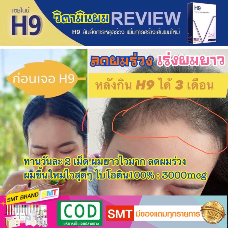 H9 วิตามินผมดก แบบทาน ลดผมร่วง เร่งผมยาว แบ่งขาย ไบโอติน 3000 ต่อเม็ด ยาแก้ผมร่วง - รูปที่ 4
