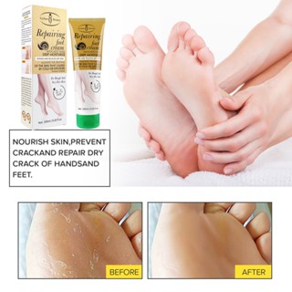 Aichun Foot Care 100g ครีมทาเท้าแตก ฟุทแคร์ ป้องกันและสมานผิวแตกบริเวณ ส้นเท้าและมือ