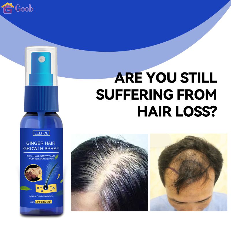 Eelhoe 30Ml Ginger Hair Spray Hair Growth Care สารละลายธาตุอาหาร【Goob】