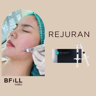 Rejuran Healer รีจูรัน (Repair &amp; Healing &amp; Anti-Ageing)