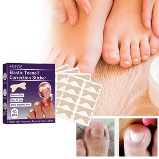 【AG】50Pcs/Set Toenail Patches Self-Adhesive Waterproof Correction Stickers Ingrown Corrector for Foot