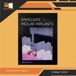 Immediate Molar Implants